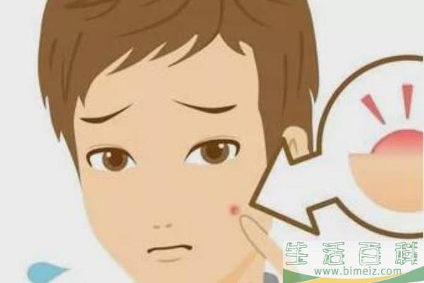 青春痘的原因是什么 青春痘的痘印怎么消除