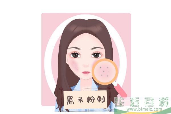 青春痘是怎么样的 青春痘是螨虫引起的吗