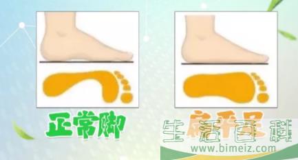 扁平足做什么动作可以改善3