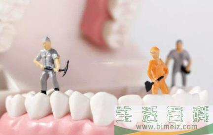 牙结石不洗牙有别的方法吗1