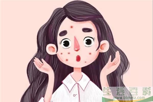 闭口粉刺怎么可以有效去除 闭口粉刺是什么原因引起的