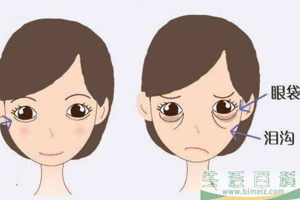 眼袋为什么是青黑色 眼袋为什么早上冰敷晚上热敷
