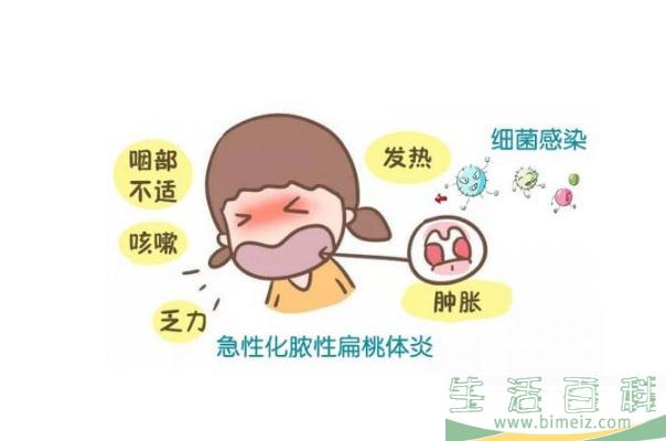扁桃体发炎会引起头痛吗 扁桃体发炎会自己自愈吗