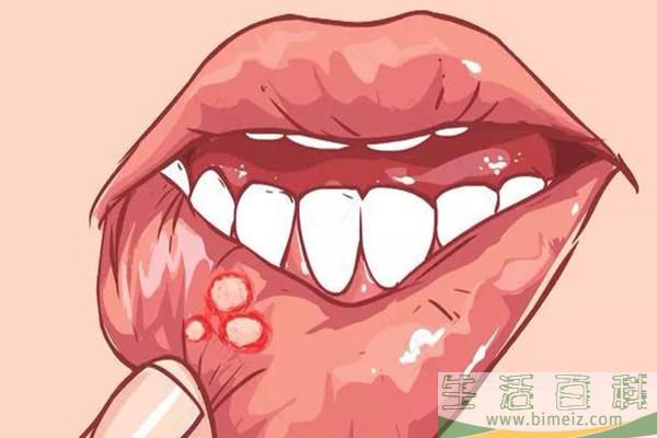 口腔溃疡会恶化吗 口腔溃疡恶化会怎么样