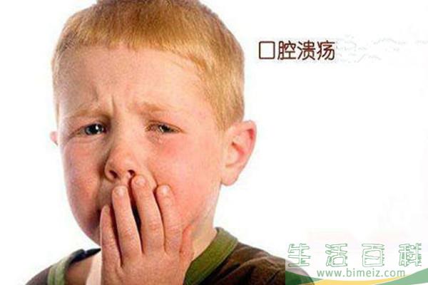 口腔溃疡有忌口吗 口腔溃疡可以吃冰的东西吗