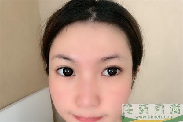 线雕几天能消肿 线雕几天可以洗头
