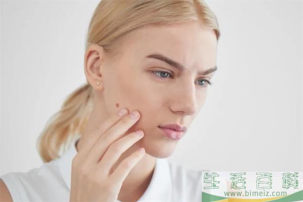 色斑会自己消退吗_去除肌肤色斑的方法有哪些