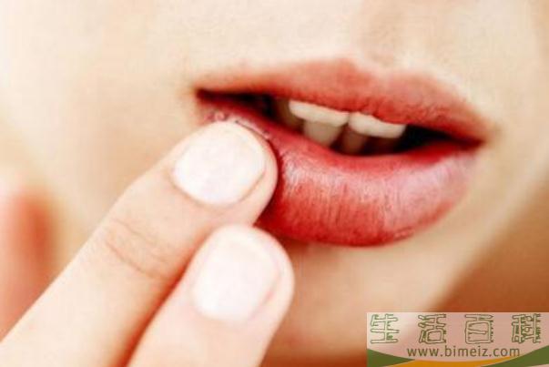 口腔溃疡有脓 口腔溃疡有脓如何处理