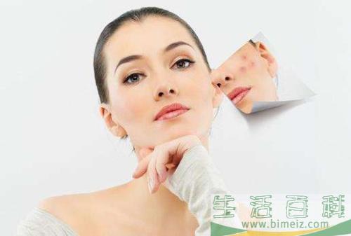 如何预防粉刺闭口 怎么去除粉刺
