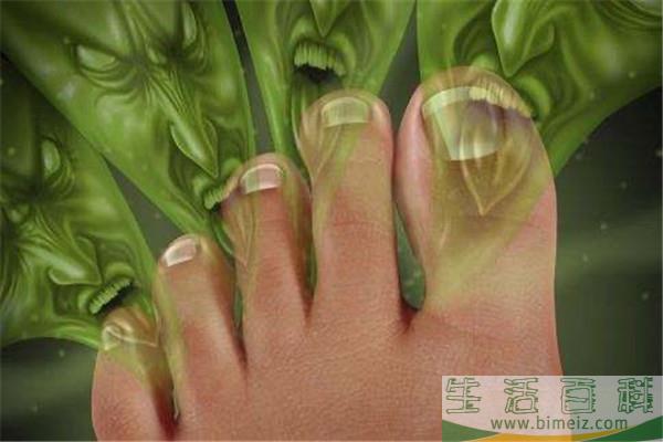 脚出汗还有味怎么办 脚后跟疼是什么原因