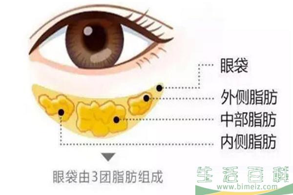韩式去眼袋有痛感吗 韩式去眼袋会打麻药吗 