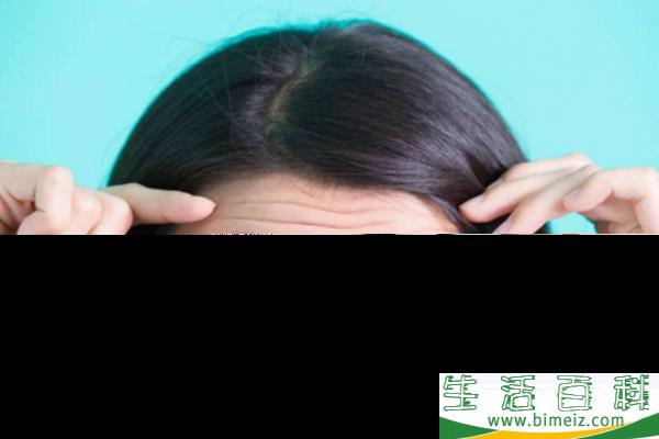 年轻人为什么有抬头纹 年轻人有抬头纹的原因