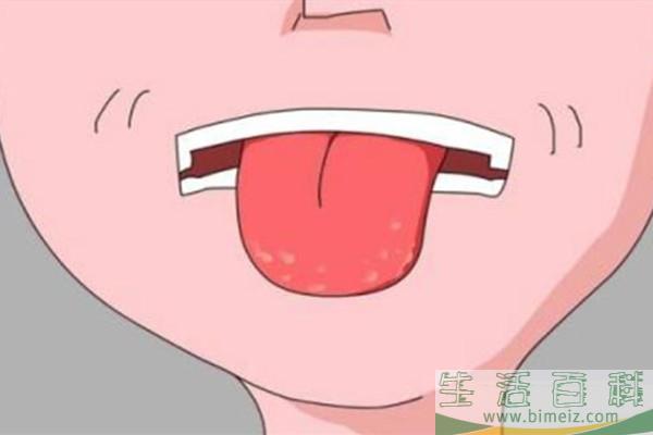 正常的舌苔是什么颜色 正常舌苔的特点