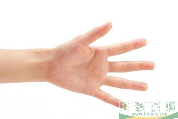 手汗症能自愈吗 手汗症太严重怎么办