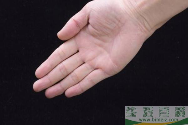 手汗症能自愈吗 手汗症太严重怎么办