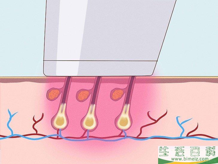 怎么不用剃刀也能除掉男性阴毛