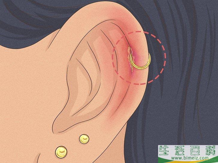 怎么自己安全地给耳骨穿孔