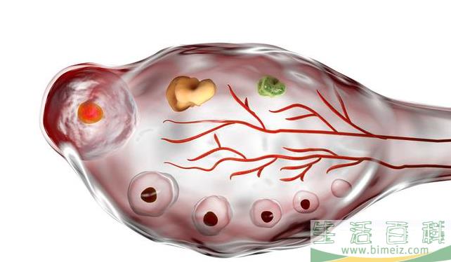 多囊促排怀孕一定要保胎吗 多囊怀孕了怎么保胎