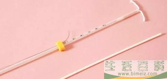 曼月乐环能够治疗哪些疾病 曼月乐环的作用与功效