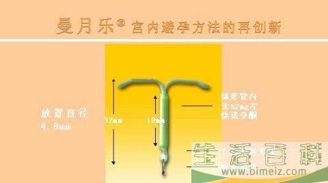 曼月乐环适用哪种人 带曼月乐环都有哪些效果