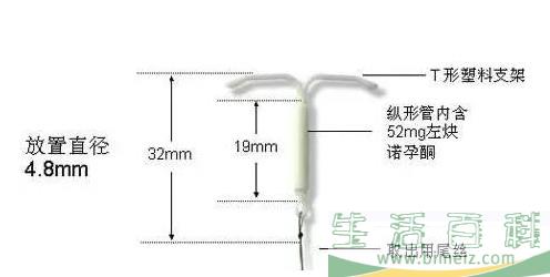 曼月乐环要多少钱 上曼月乐环多少钱一个