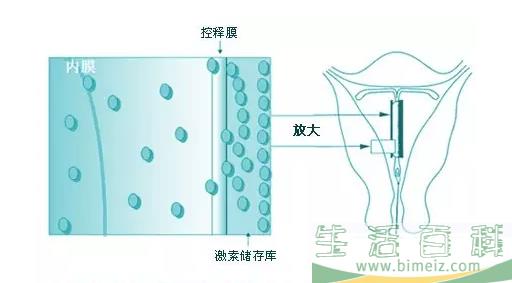 上曼月乐环不来月经正常吗 上曼月乐环月经量减少有影响吗