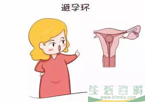 上曼月乐环后多久可以性生活 放置曼月乐环需要卧床休息吗