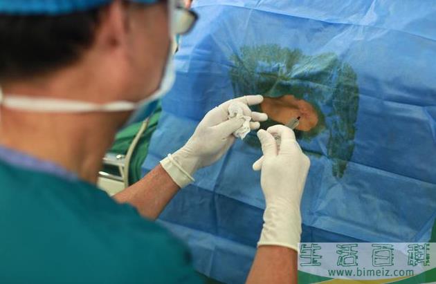 剖腹产打麻药打哪里 剖腹产打麻药有什么感觉