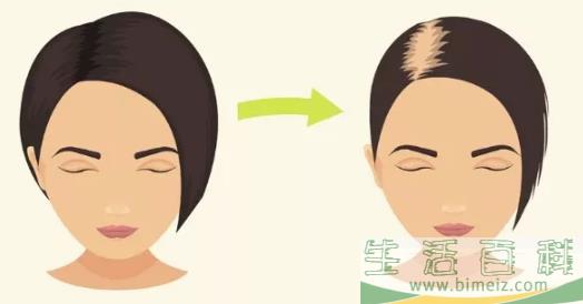 产后脱发多久能长回来 产后脱发怎么洗头发