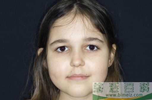 女性容易贫血？日常做到这5点能预防