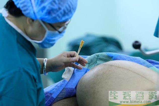 生孩子前一定要刮毛吗 备皮的方法有哪些