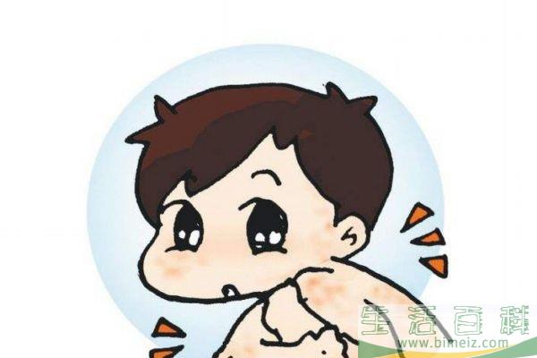 湿疹的形成原因有什么呢 如何治疗湿疹呢