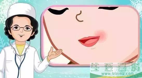 口角炎吃什么好 口角炎不适合吃什么食物