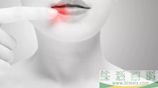 口角炎吃什么好 口角炎不适合吃什么食物