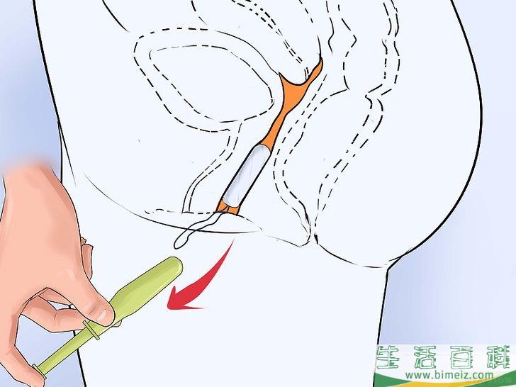 如何无痛地使用卫生棉条