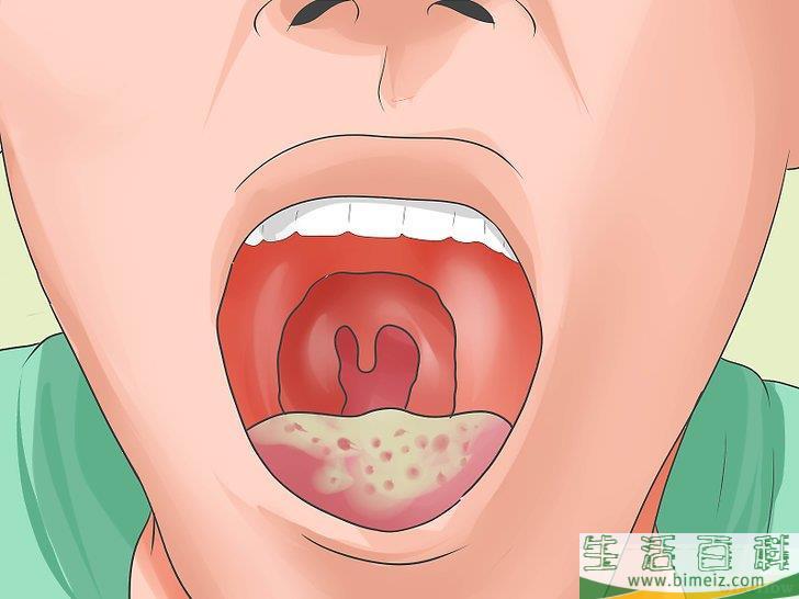 如何识别人类免疫缺陷病毒（HIV）感染症状