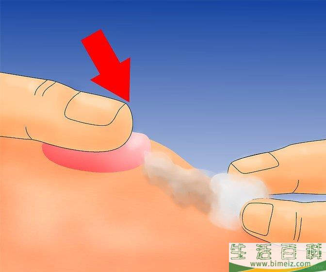 如何治疗水泡
