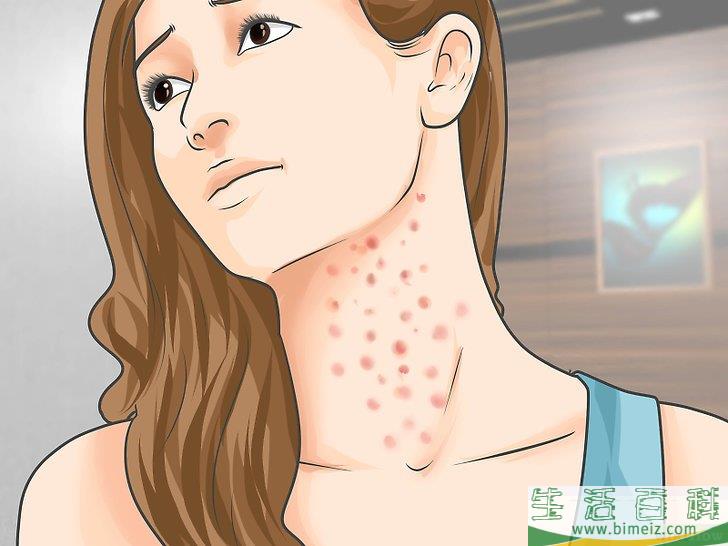 如何识别人类免疫缺陷病毒（HIV）感染症状