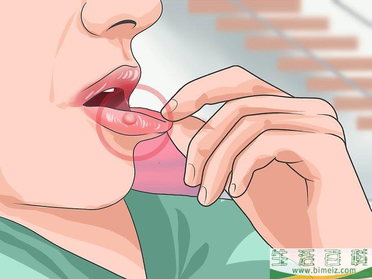 如何识别人类免疫缺陷病毒（HIV）感染症状