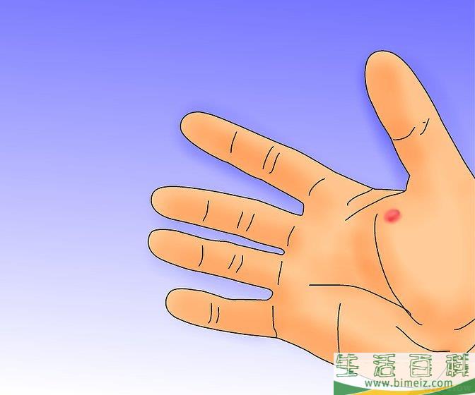如何治疗水泡