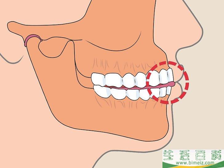 怎么改变牙关紧闭的习惯