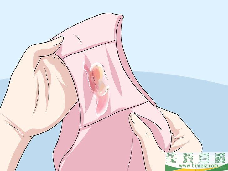 怎么识别衣原体症状(适合女性)