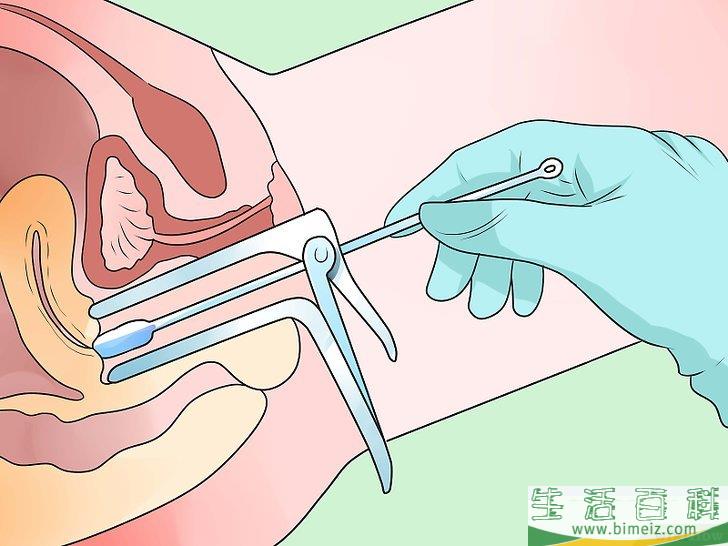 怎么识别衣原体症状(适合女性)